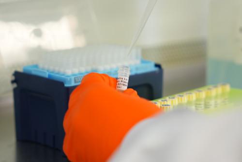 AbBaltis offers a large and diverse range of human plasma and serum.