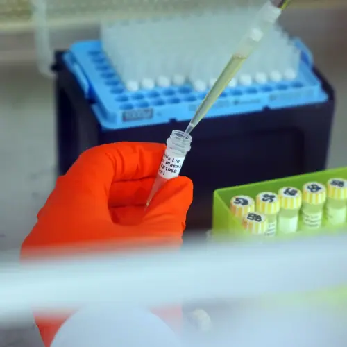 Bulk Autoimmune Disease State Plasma
